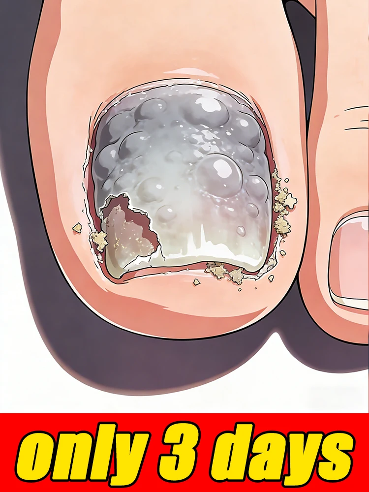 

2026 NE Профессиональные инструменты для удаления грязи и пластика; инструменты для ногтей. Самый популярный.