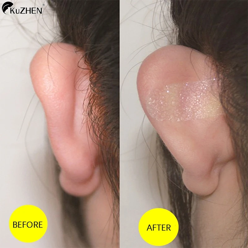 18Pcs/Box Elf Ear Plasters Cosmetic Ear Corrector Protruding Ear Solution Elf Ear Stickers Big Ear Supporter Aesthetic Corrector