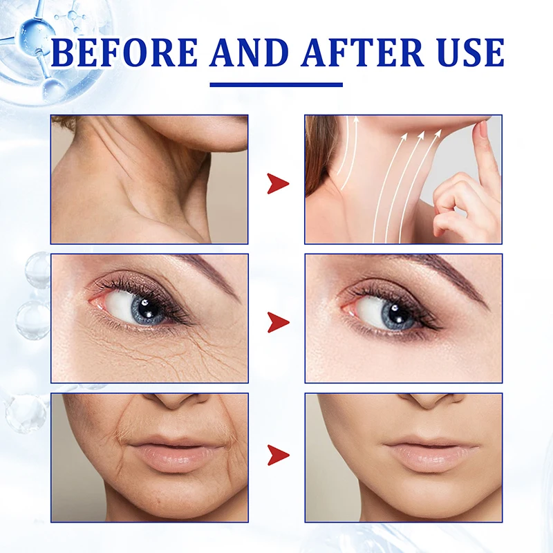 Anti-Ageing Effective Anti-Wrinkle Facial Serum Remove Facial Wrinkles Fine Lines Around Eyes Crow\'s Feet Neck Wrinkl Cosmetic