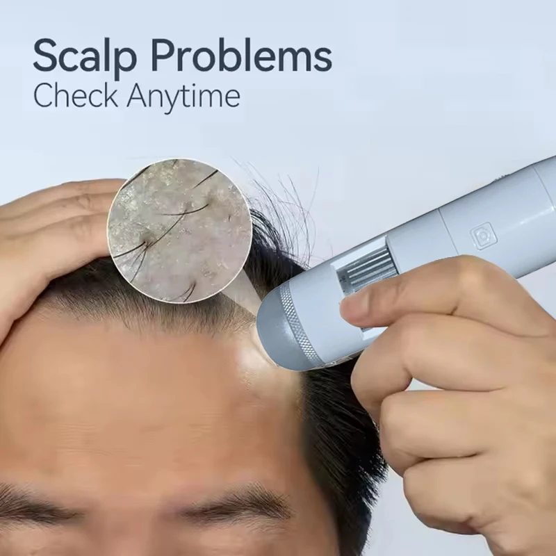 Bezprzewodowy dermatoskop do skóry głowy i twarzy, analizator skóry, lupa do skóry 1000X, aparat do diagnostyki skóry głowy, mikroskop WiFi do testowania skóry.