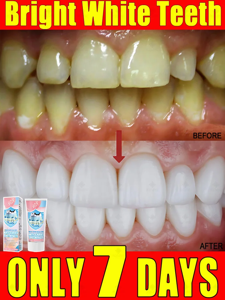 Brilliant tooth whitening paste, strengthens gums and protects you