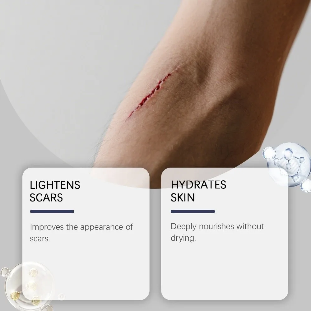 Lightweight Scar Treatment Stick Easy to Apply Hypoallergenic Silicone Sticks Gentle Formula Silicone Scar Stick Face Treatment