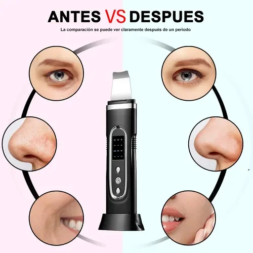 Ultrasonic Facial Spatula Blackhead Remover Deep Pore Cleaner Ion Vibration Acne Treatment Skin Lifting Exfoliation Multifunctio