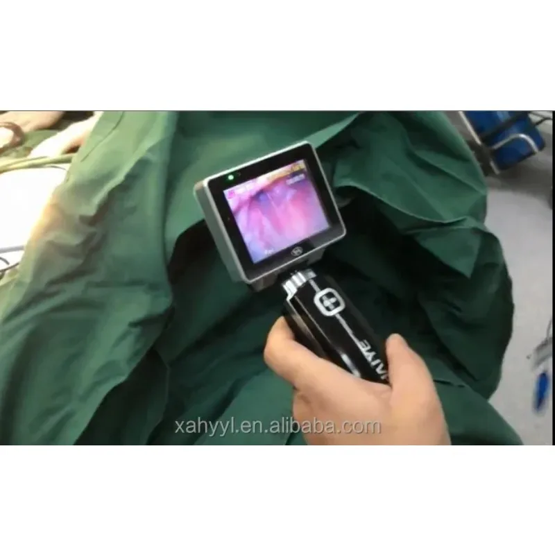 2025/adulto e pediátrico vídeo laringoscópio portátil ce 3 Polegada tft tela colorida anestesiaequipamento