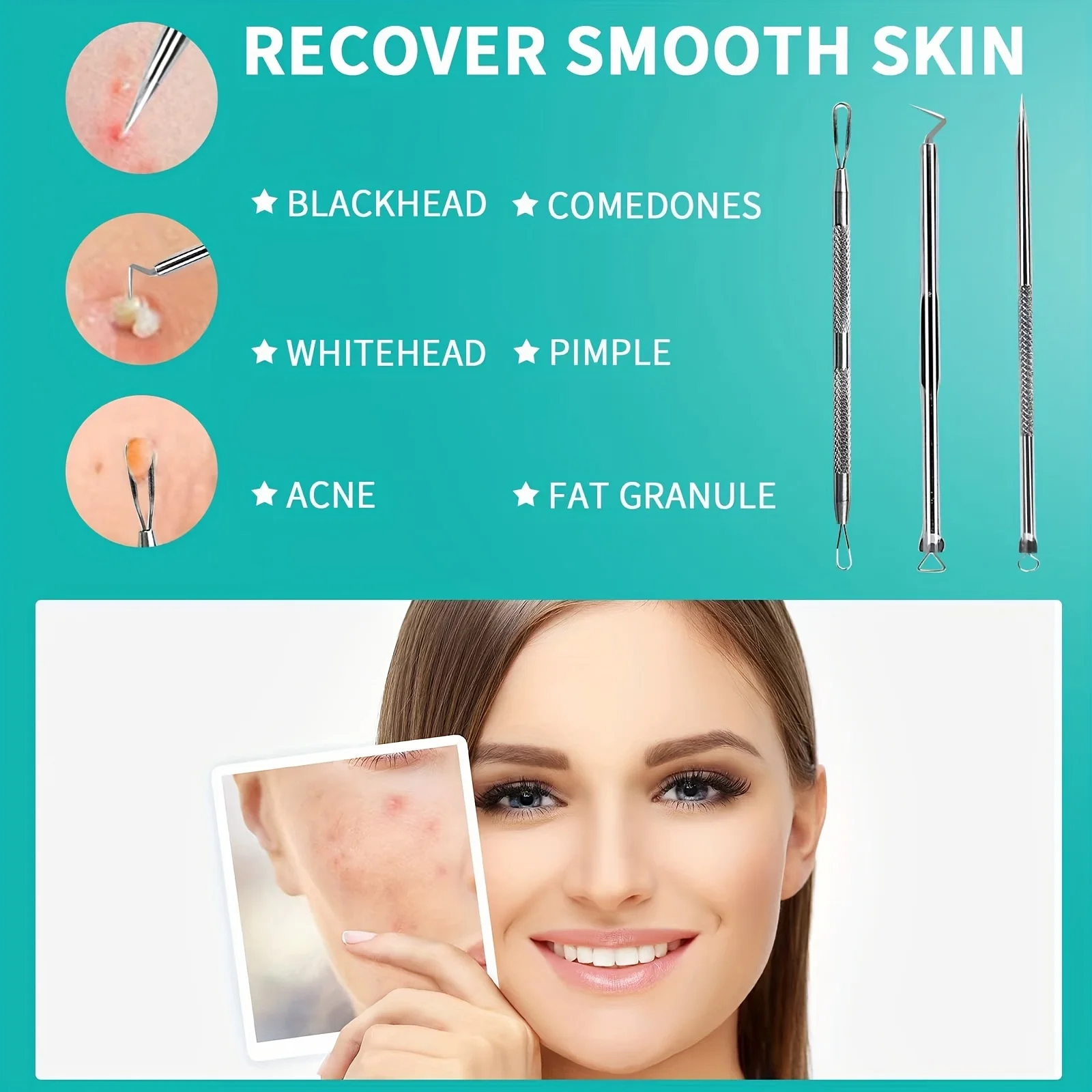 Ferramenta popper de espinhas 3 peças, extrator de espinhas de aço inoxidável, pinça de cravo, kit de remoção de acne extrator de comedões para manchas,