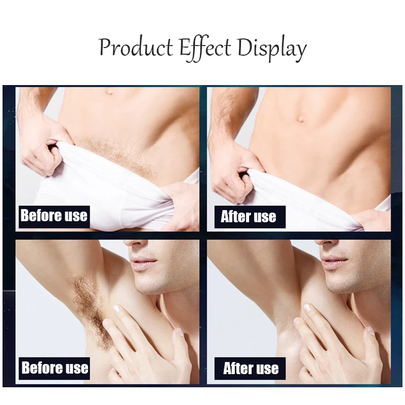 WAIKIL-جهاز تشذيب شعر الجسم الكهربائي للرجال ، مقص احترافي ، سكين تشذيب شعر مقاوم للماء ، شحن USB ، جديد