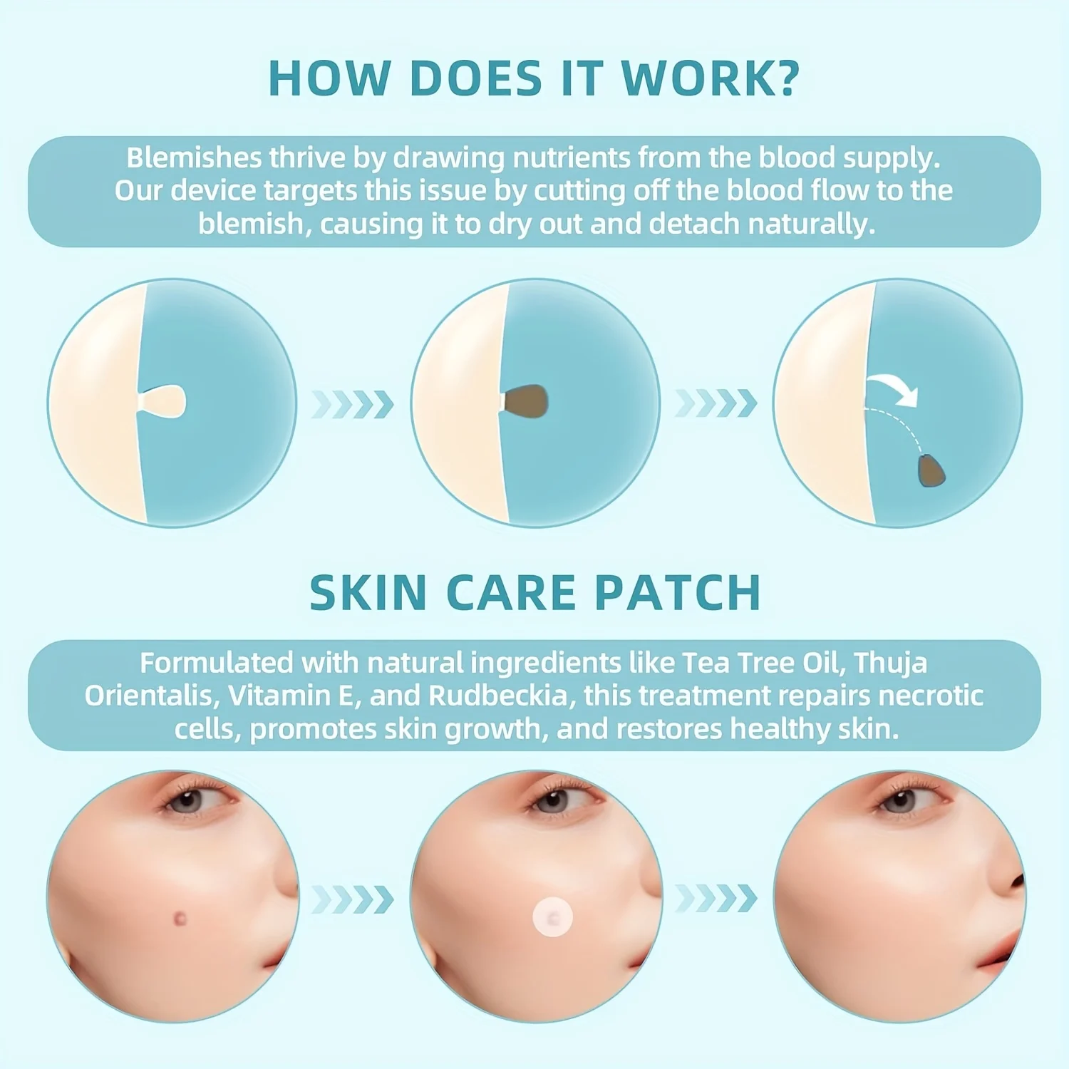 Kit d'élimination 1/2/4 pièces pour les soins de la peau, conception conviviale à une main, sûr et efficace pour un usage domestique