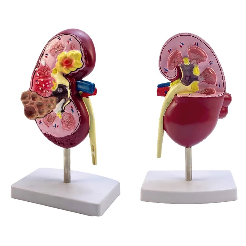 Medical teaching of renal structure of urinary system with natural large kidney model in human urology