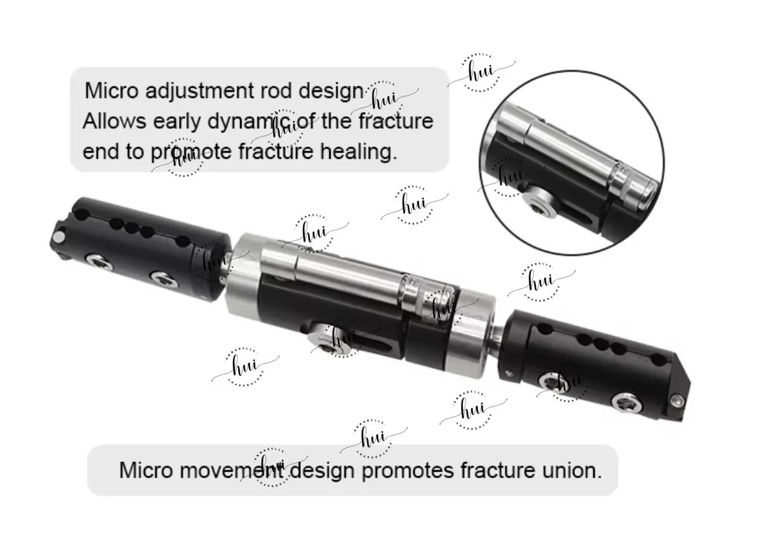 Assured Quality Orthopedic Surgical Instruments Wrist Joints External Fixator for Fracture Surgery