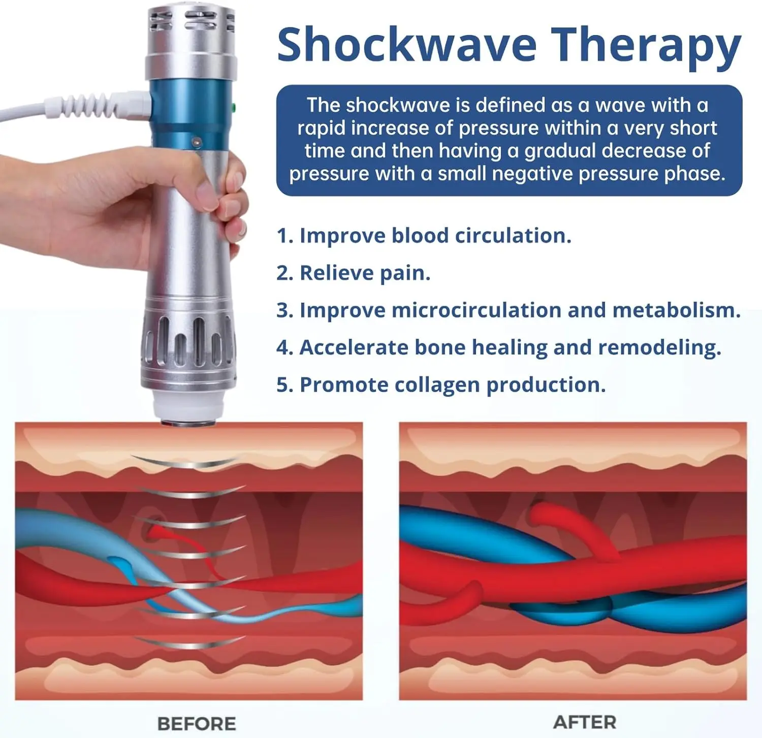 Рисунок 3 - Аппарат для ударно-волновой терапии