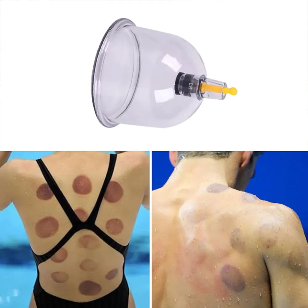 Vakuum Schröpfen Massage Jar Dosen Chinesische Medizin Körper Tasse Körper Detox Anti Cellulite Therapie Dosen Gesunde Pflege Abnehmen Glas