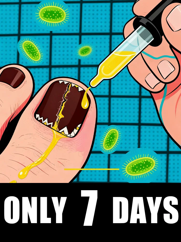 

ᑫᵘⁱᶜᵏ ᵀʳᵉᵃᵗᵐᵉⁿᵗ⸴ ᔆᵃʸ ᴳᵒᵒᵈᵇʸᵉ ᵗᵒ ᶠᵘⁿᵍᵃˡ ᴺᵃⁱˡ ᵂᵒʳʳⁱᵉˢHot-selling nail cleaning brush