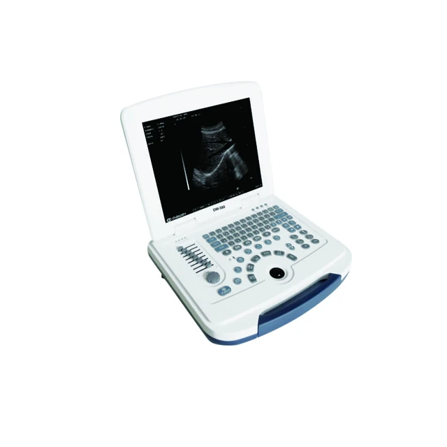 

Medical Hospital Diagnosis Portable Ultrasound Scanner Machine for pregnancy