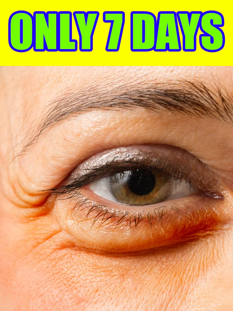 Strumenti per la cura degli occhi, Gli occhi diventano più strette e le borse per gli occhi scompare, Il massaggio risolve vari problemi, spedizione gratuita