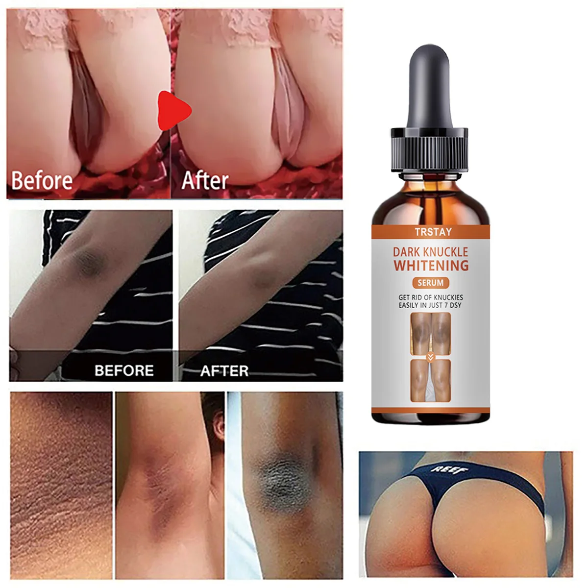 

TRSTAY Отбеливающая сыворотка для темных костяшек пальцев, осветляющий крем для костяшек пальцев, который легко в просто 7 дней, крем для ухода за кожей, крем для тела