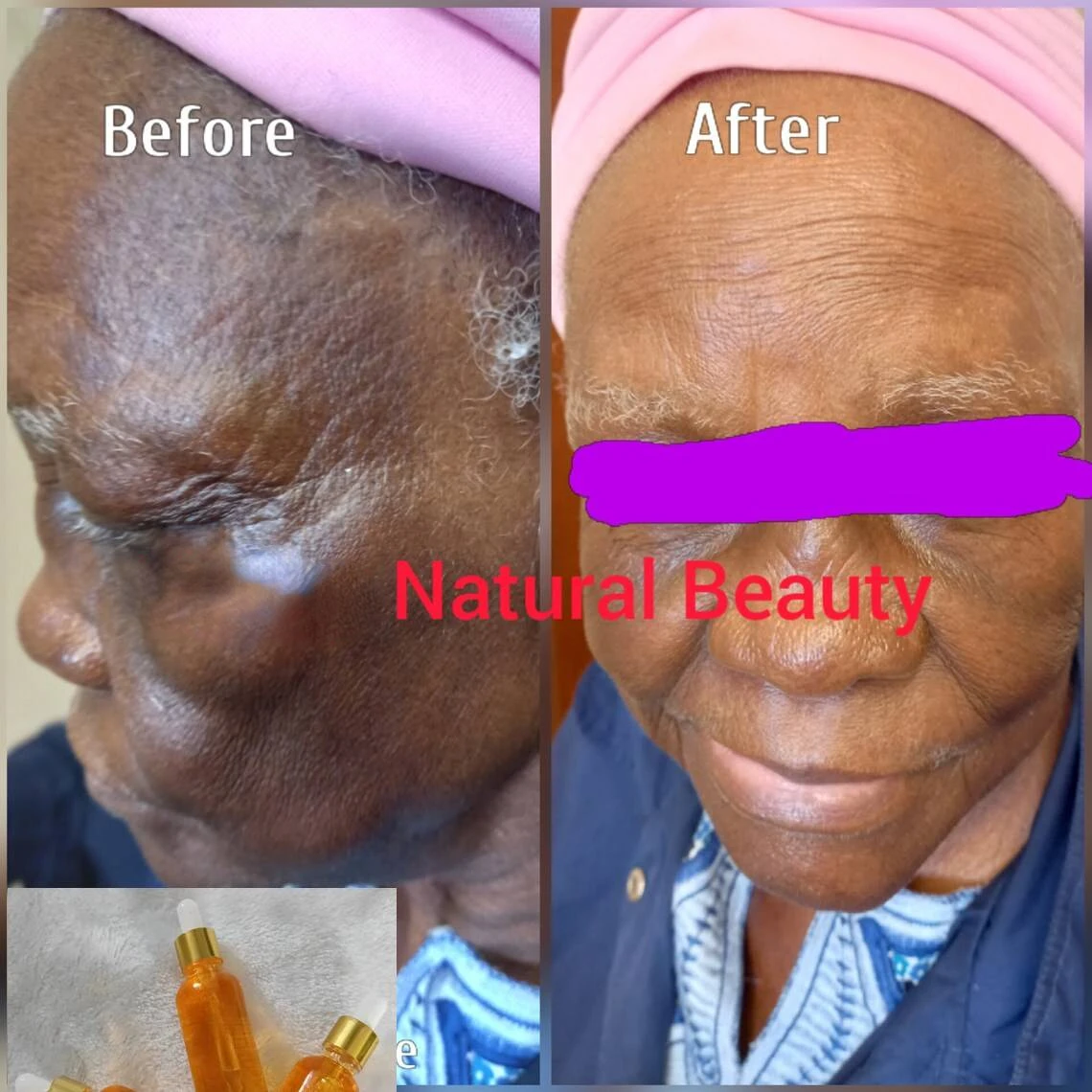 

Натуральный отбеливающий крем для лица, сыворотка для коррекции пигмента темных пятен, сыворотка для лица - отбеливание кожи, осветляющий глутатион