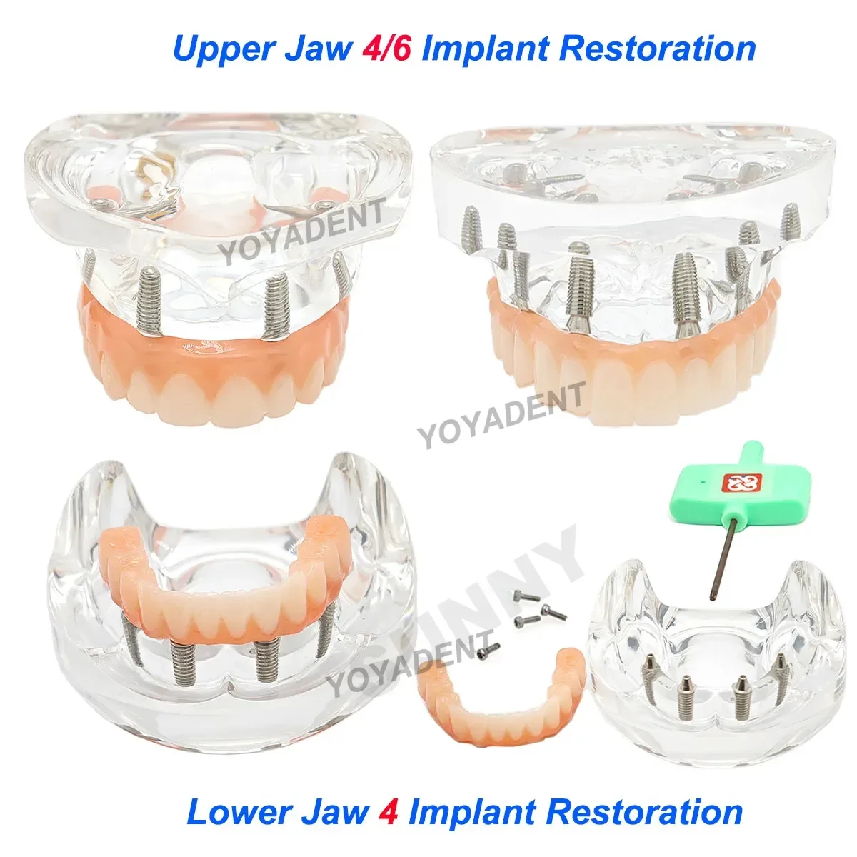 

Dental Teeth Model simulation Transparent Upper Jaw 4/6 Lower Jaw 4 Implant Restoration Dentist Teaching Studying Demo