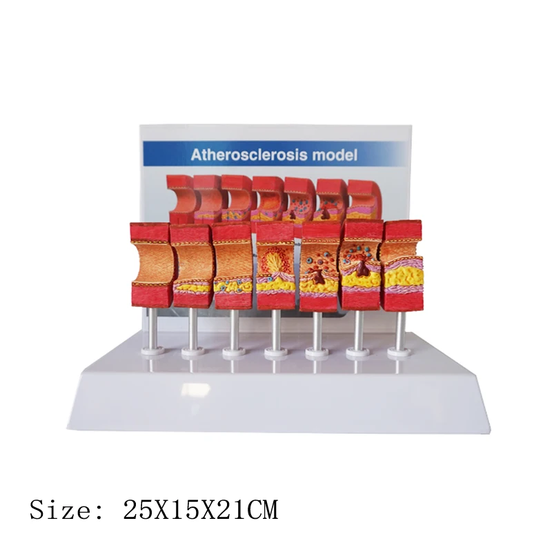 Arterial Vessel Atherosclerosis Model Middle-Aged And Elderly Blood Vessel Structure Model