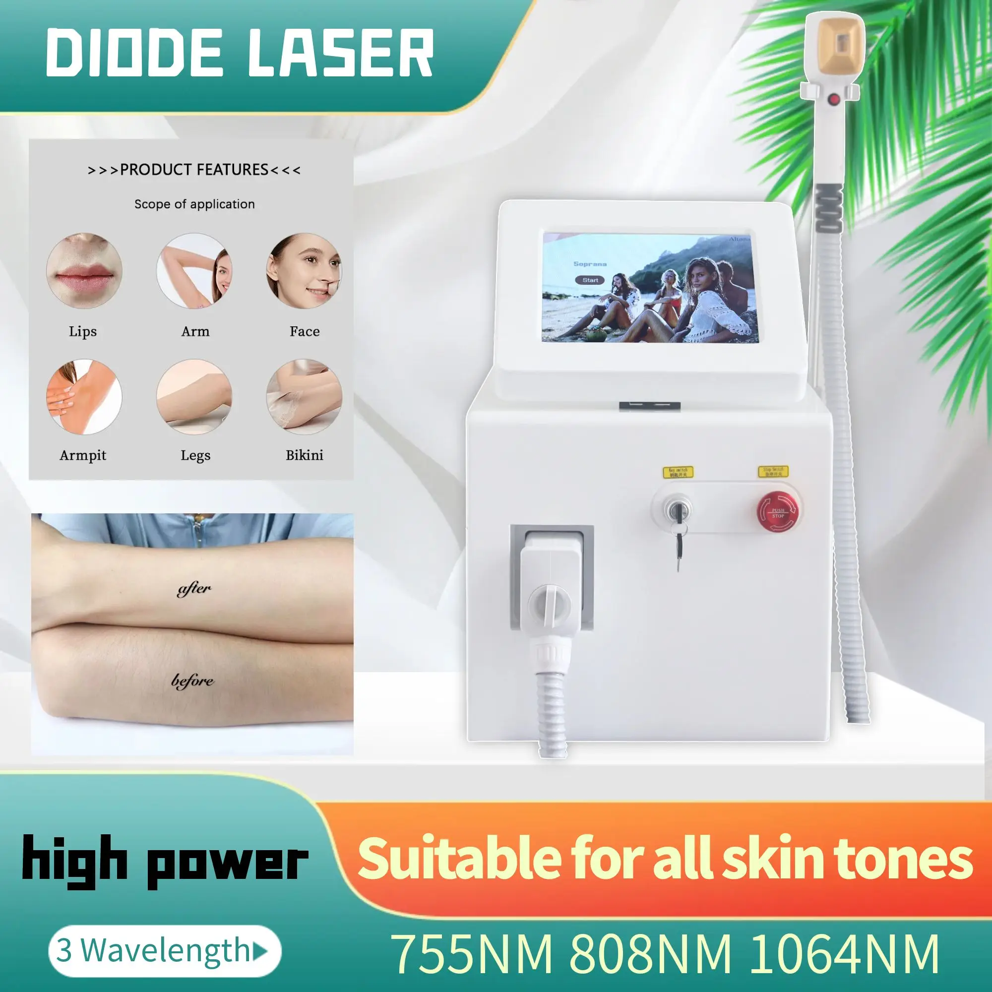 Professional 808 Permanent  Diode Ice Titanium Laser Hair Removal Machine Suitable For All Skin Tones Restore Silky Smooth Skin