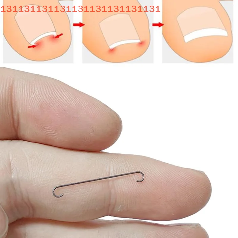 أدوات مصحح أظافر نام باديكير استعادة تضمين تو مسمار المهنية نام أظافر استقامة كليب هدفين #3