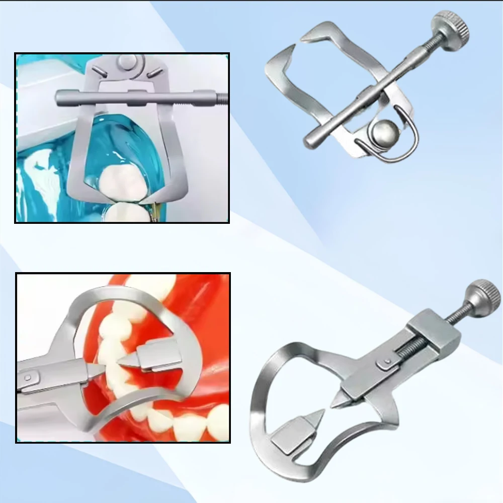 

Сепаратор зубов, разделитель зубов, клинья, фиксатор, передние зубы, ортодонтический инструмент, матрица, матрица, резиновая плотина