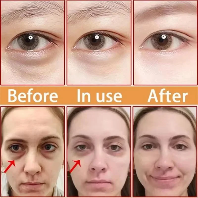 인스턴트 아이 백 제거 크림 콜라겐 안티 링클 퍼밍 스킨 페이드 파인 라인 안티 다크 서클 붓기 밝게 아이 케어