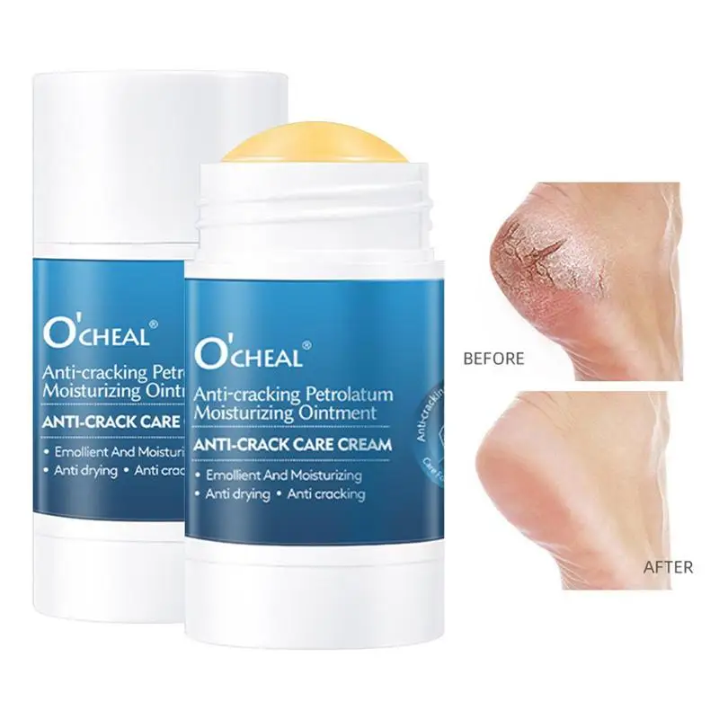 Cream For Dry Cracked Feet Heels Hands Body Repairing Care Deeply Moisturizing Callus Dead Skin Remove Foot Care