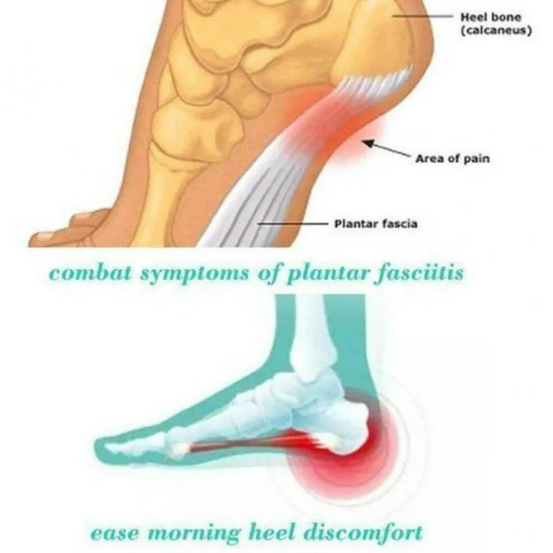 الجوارب المهنية للجنسين ذاتية التدفئة الرعاية الصحية الجوارب التورمالين العلاج المغناطيسي مريحة للتنفس مدلك قدم دافئ