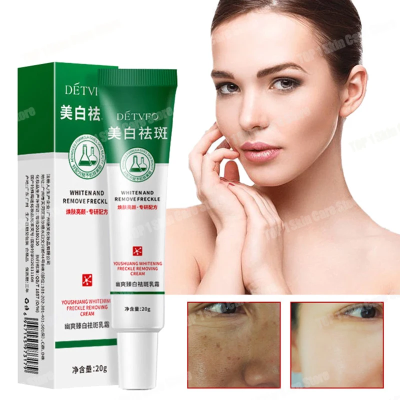 Freckle Whitening Cream Black Dots Melasma Remover Anti Brown Stain Lighten Pigmentation Moisturizing Korean Skin Care Products