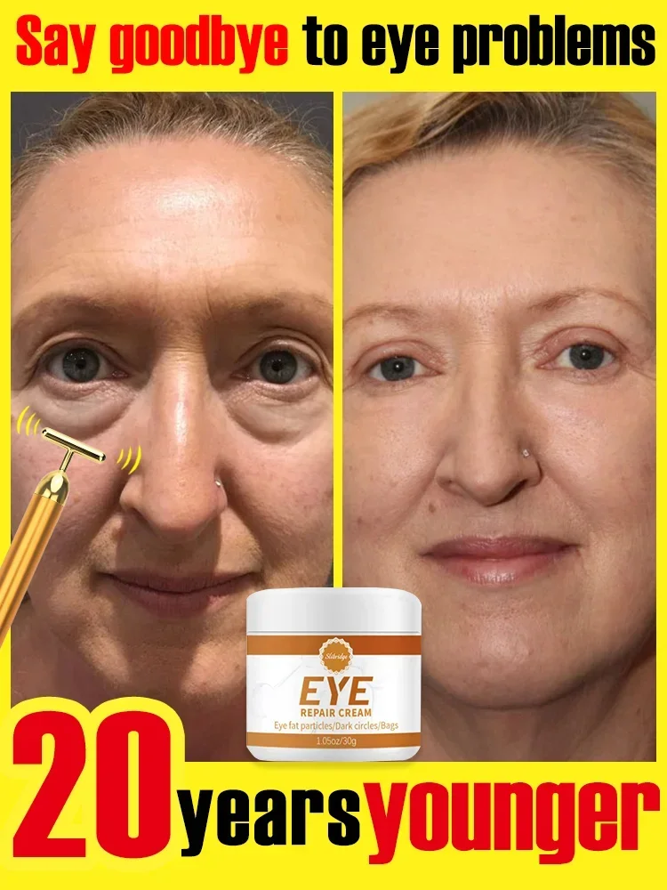 

Remove eye wrinkles