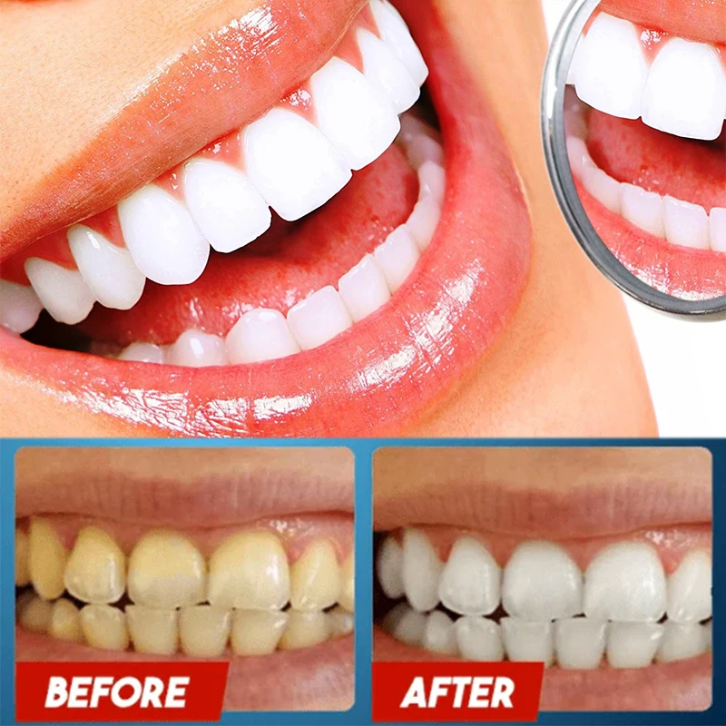 

Whitening Toothpaste Oral Cleaning Remove Plaque Yellow Teeth Stain Gum