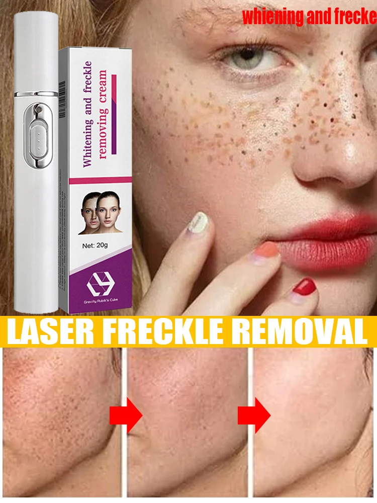 

Laser Dark Spots