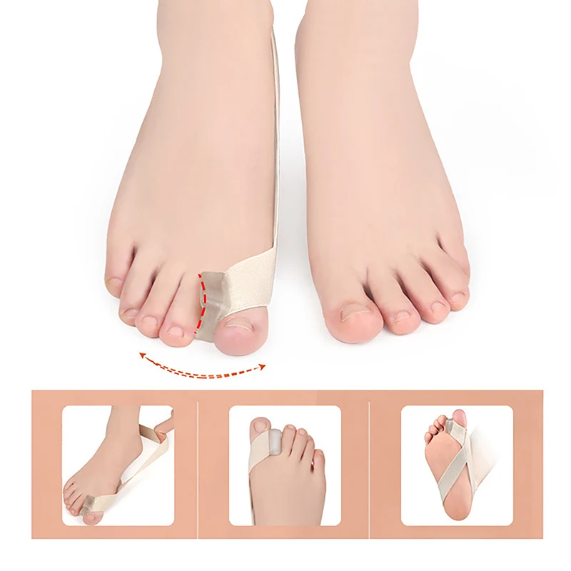 Hallux Valgus Corrector One Side Thumb Valgus Corrector สายรัดความตึงเครียดบรรเทาอาการปวด Toefinger Separator Toe Straightener เครื่องมือ