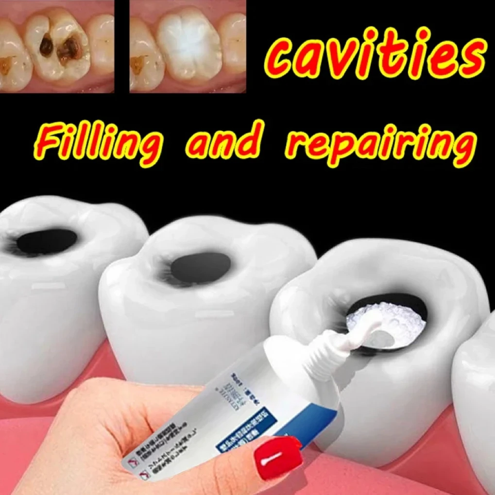 

200ML Quick Repair of Cavities Caries Removal of Plaque Stains Decay Whitening Yellowing Repair Teeth Teeth Whitening 2023 New