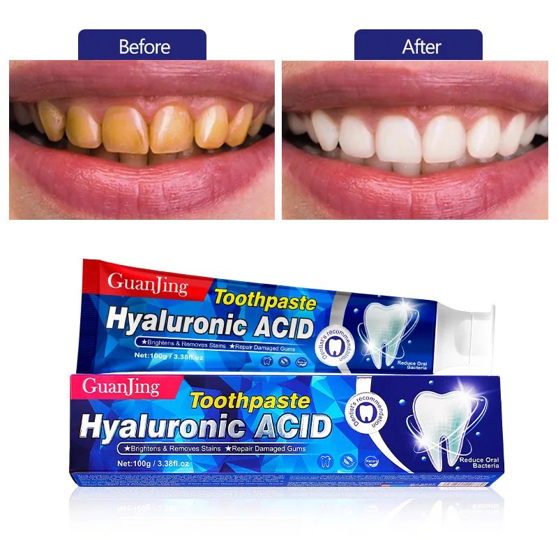 Toothpaste Gum Repair ácido hialurônico para dentes mais brancos, Creme dental restaurador, Aliviar goma e problemas de tecidos macios