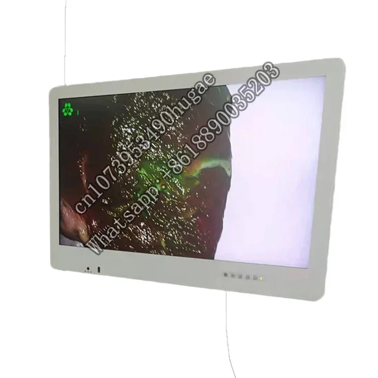4k 32 inch professional endoscopic medical monitors for laparoscopico