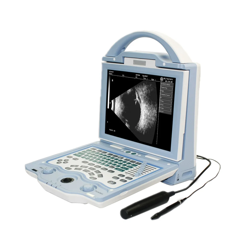 Portable high Resolution 10.4 Inch Screen Ophthalmology A/B Ultrasound Scanner