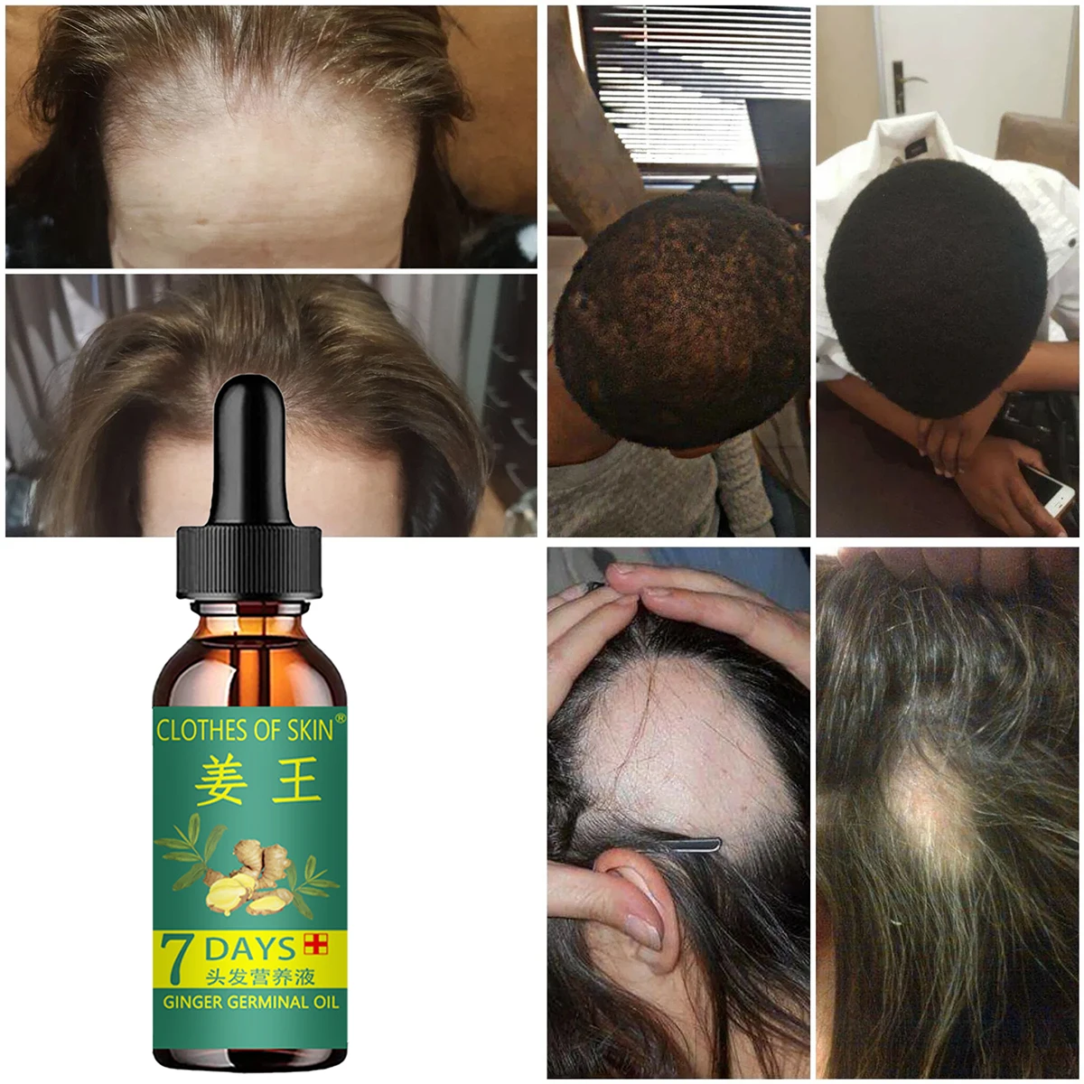 2022 New Hair Growth Oil Essence Natural Beauty Hair Growth Fluid Chinese Herbal Essence Oil Products for Black Women