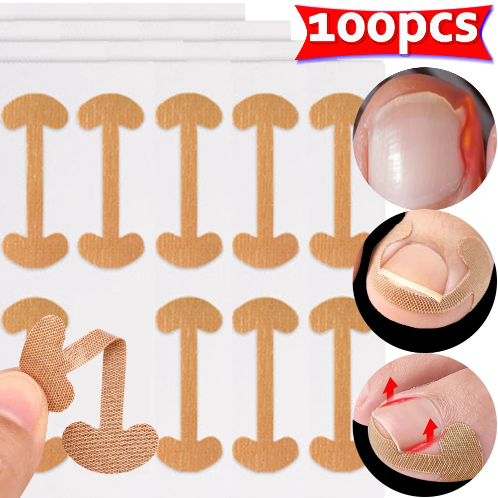 100pcs Nail Correction Stickers Professional Painless Ingrown Toenail Correction Strips Waterproof Breathable Treatment Pedicure