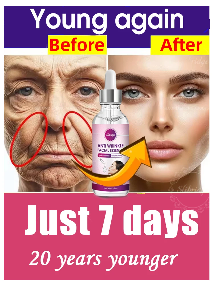 

ACE Erase Wrinkles in Just 7 Days 20 years younger