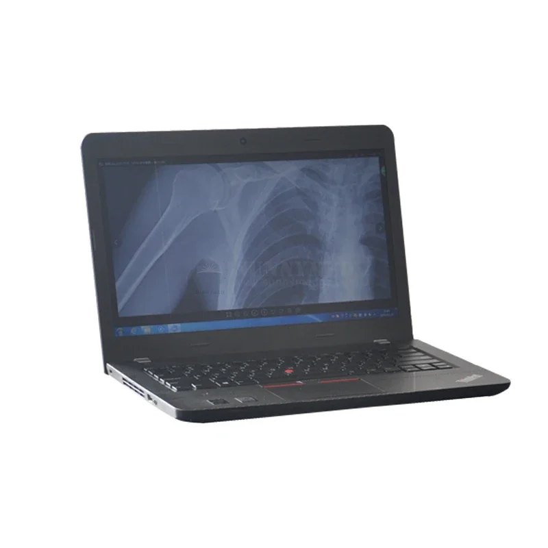 SY-D019BDR Hochfrequenz 5KW Mobile DR Digital Röntgenmaschine Preis für Menschen