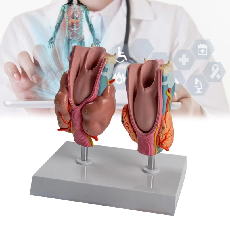

Human Pathological Thyroid Anatomy Model Teaching Aid, Anatomical Pathological Thyroid Throat Model for Educational Use