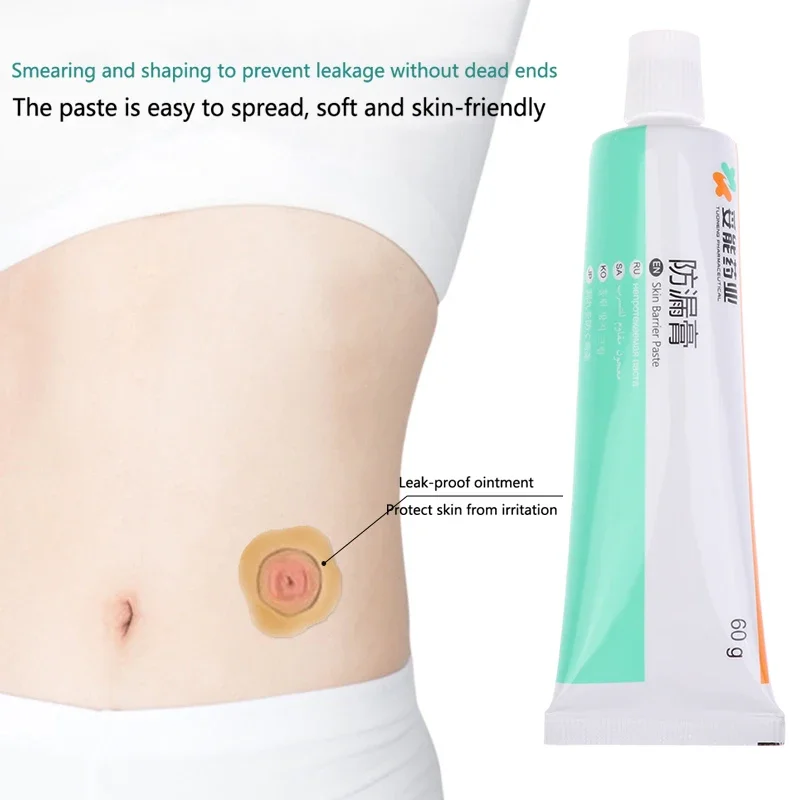 

60g Skin Care Powder Stoma Accessories After Surgery Cream Tool Barrier Paste Leak-proof For Ostomy Bag Anti Ointment