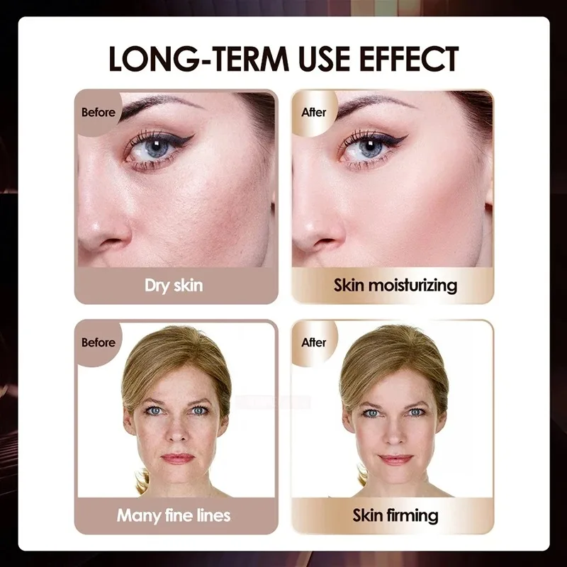 Novo mini hifu tratamento de beleza facial de radiofrequência ems micro corrente rejuvenescimento da pele levantamento aperto beleza instrumentt