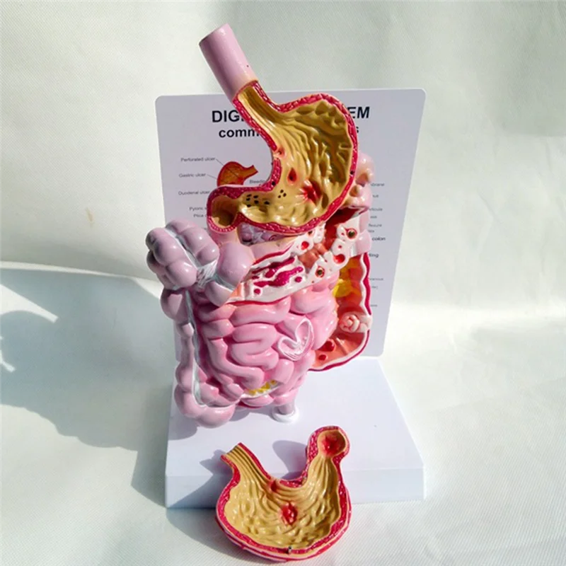نموذج تشريح الأعضاء الداخلية البشرية الجهاز الهضمي المعدة الأمعاء Cecum Rectum نموذج هيكل الثنائي
