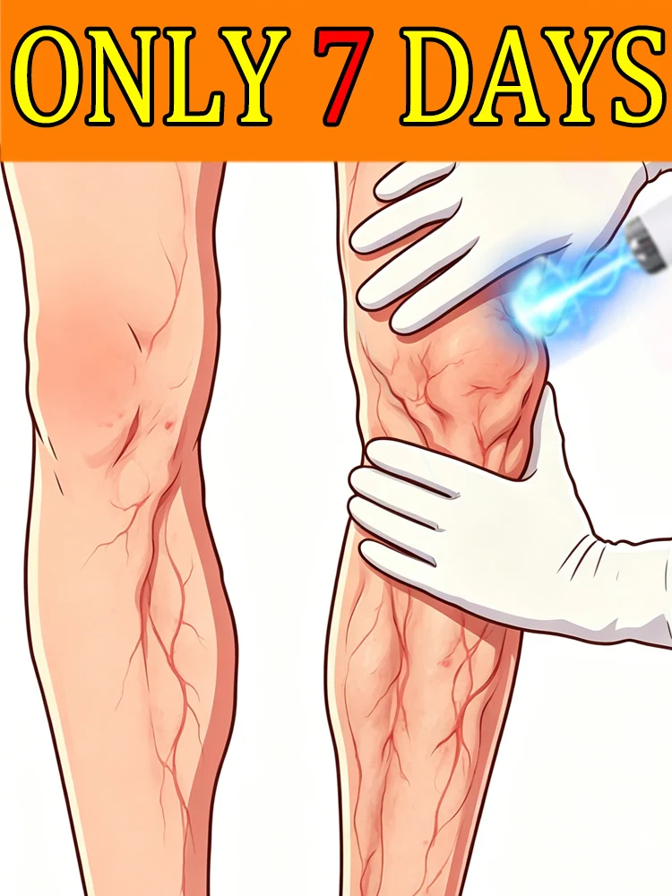 

Help people with varicose veins say goodbye to pain. 100% fast and effective results.