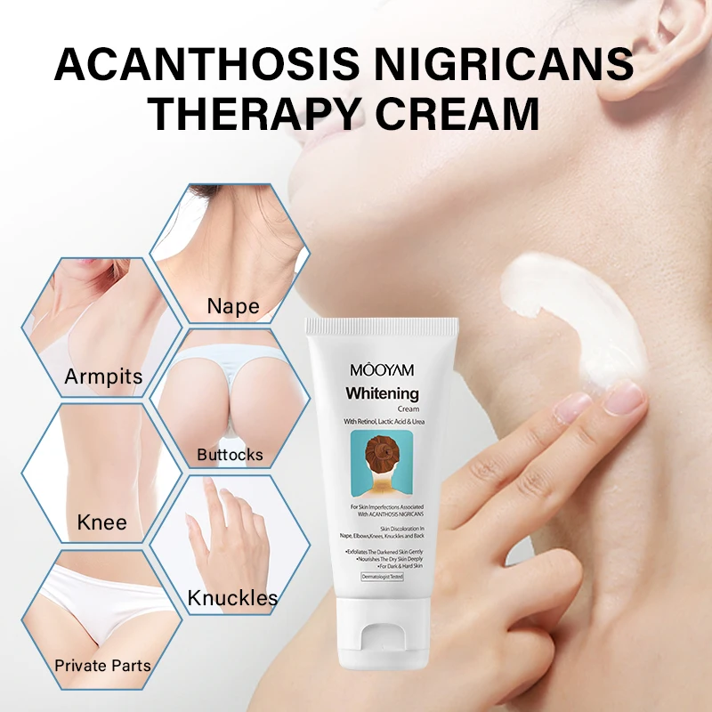 Acanthosis Nigricans Therapy Neck Cream Skin Tightening Underarm Elbows Armpit Cream Treatment Dark Spot Remover For Body