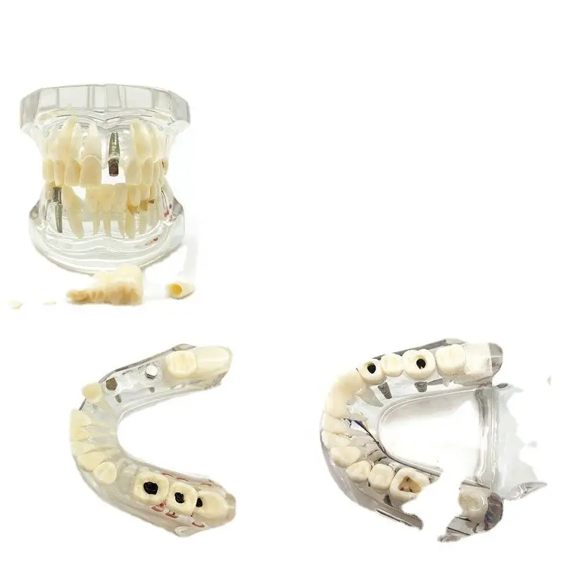 Dental Lab Complete Model Dental Training Teaching Student Practice Dentist Demonstration Teeth Model
