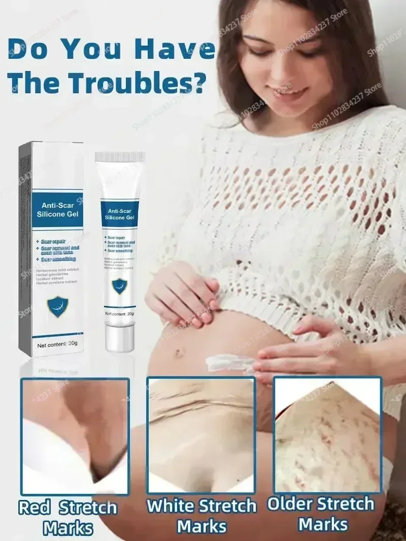 Old Stretch Marks Creme para Mulheres Grávidas, Eliminar Vermelho e Branco