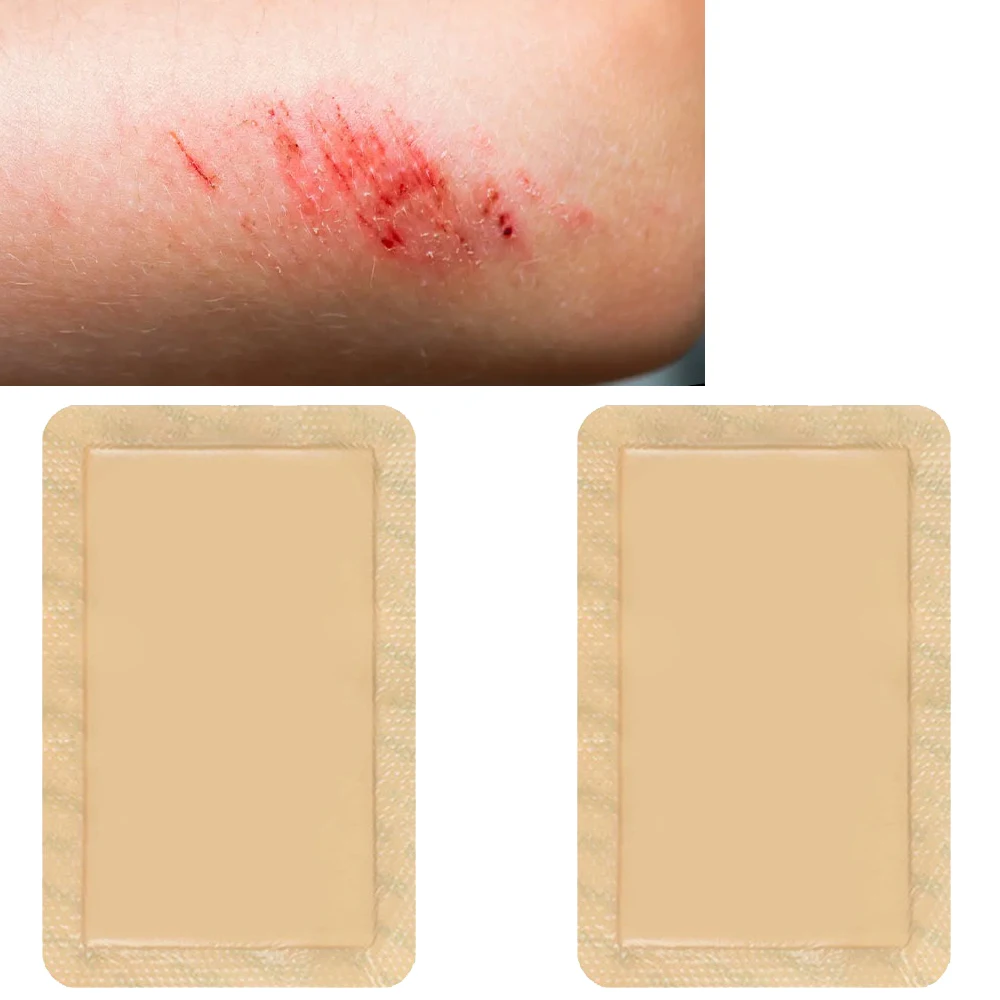 10*20cm Health Silicone Silica Gel Foam Dressing Foam Wound Bedsore Infiltration Liquid Absorption Pressure Ulcer Paste